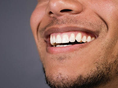 M. Kurt Berky, DDS, PC | Root Canals, Emergency Treatment and Gingivitis