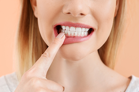 M. Kurt Berky, DDS, PC | Dental Bridges, Fluoride Treatment and ClearCorrect reg 
